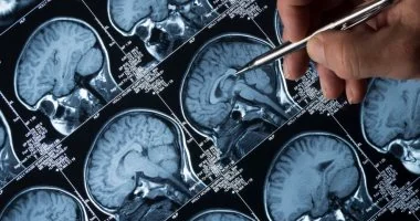 «اكتشف المخاطر المبكرة» دراسة تحذيرية: 10 حالات صحية مرتبطة بمرض الزهايمر سنوات قبل التشخيص